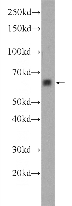 human brain tissue were subjected to SDS PAGE followed by western blot with Catalog No:107699(ACSM2A antibody) at dilution of 1:1000