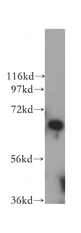 HeLa cells were subjected to SDS PAGE followed by western blot with Catalog No:113780(PGBD3 antibody) at dilution of 1:500