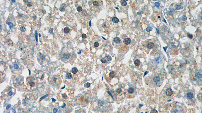 Immunohistochemistry of paraffin-embedded mouse liver tissue slide using Catalog No:117162(ZNF326 Antibody) at dilution of 1:100 (under 40x lens).
