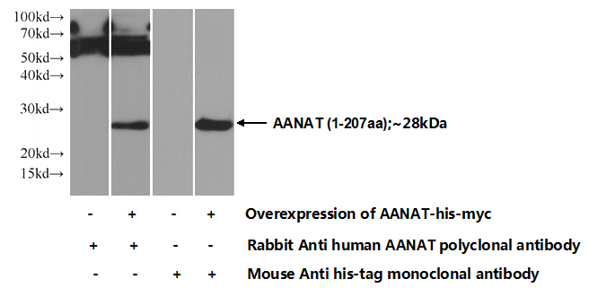 Transfected HEK-293 cells were subjected to SDS PAGE followed by western blot with Catalog No:107673(AANAT Antibody) at dilution of 1:500