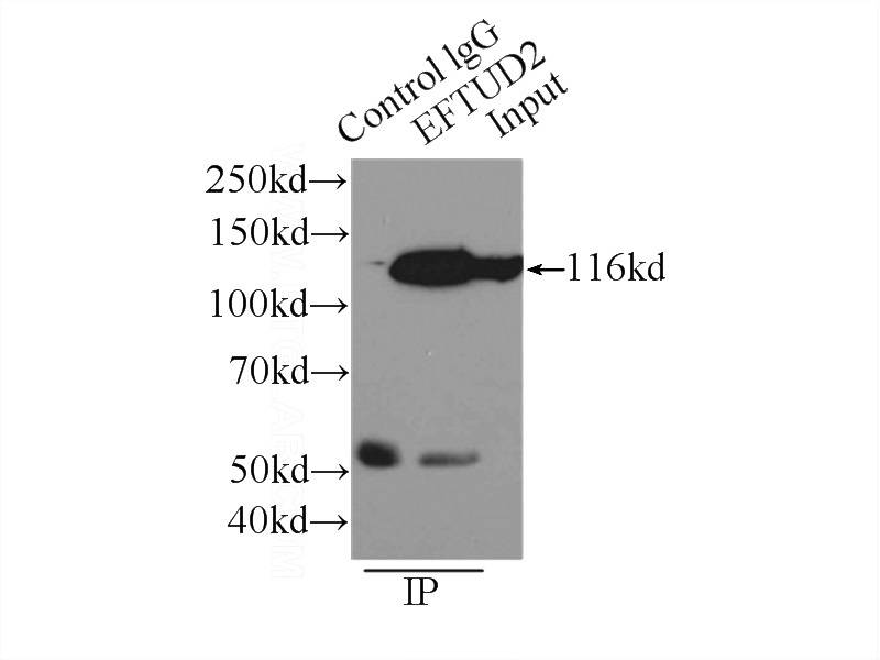 IP Result of anti-EFTUD2 (IP:Catalog No:110213, 3ug; Detection:Catalog No:110213 1:1000) with HeLa cells lysate 4650ug.