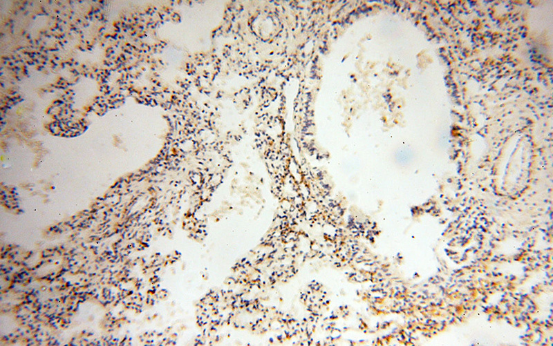 Immunohistochemical of paraffin-embedded human lung using Catalog No:112609(MICAL1 antibody) at dilution of 1:100 (under 10x lens)
