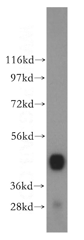 human skeletal muscle tissue were subjected to SDS PAGE followed by western blot with Catalog No:110255(ENO3 antibody) at dilution of 1:500