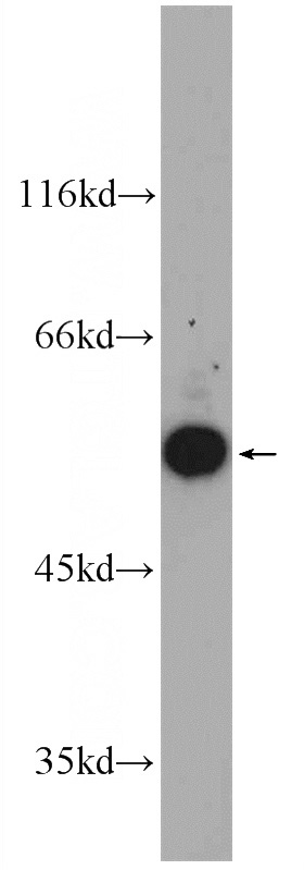 mouse brain tissue were subjected to SDS PAGE followed by western blot with Catalog No:110925(GDI1 Antibody) at dilution of 1:1000