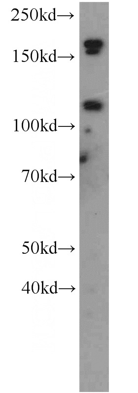 K-562 cells were subjected to SDS PAGE followed by western blot with Catalog No:113019(NALP3 antibody) at dilution of 1:500
