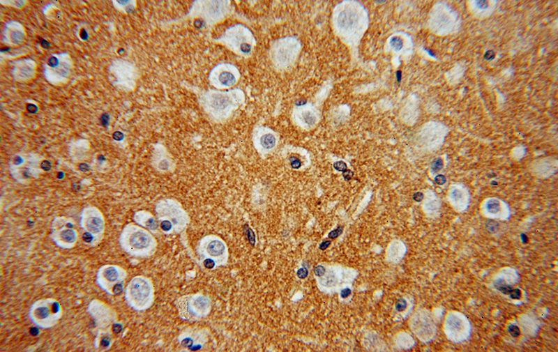 Immunohistochemical of paraffin-embedded human brain using Catalog No:110735(FN3KRP antibody) at dilution of 1:50 (under 40x lens)