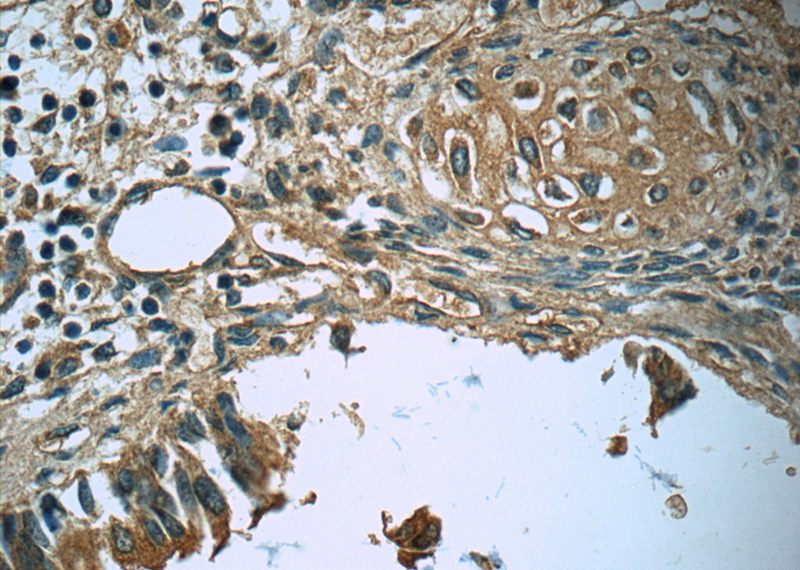 Immunohistochemistry of paraffin-embedded human lung slide using Catalog No:112659(MEPE Antibody) at dilution of 1:50 (under 40x lens)