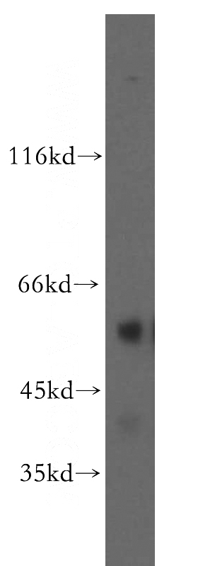 PC-3 cells were subjected to SDS PAGE followed by western blot with Catalog No:110911(NR6A1 antibody) at dilution of 1:300