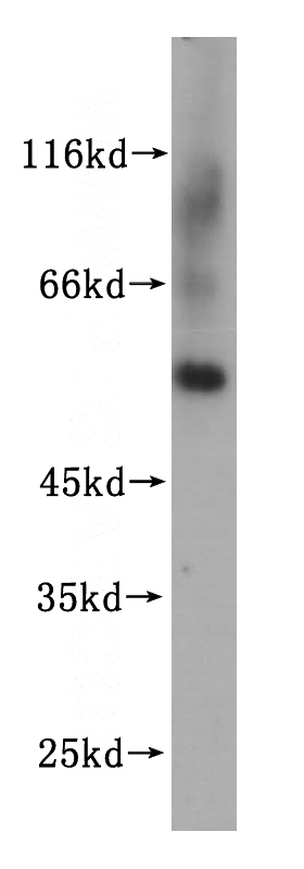 human liver tissue were subjected to SDS PAGE followed by western blot with Catalog No:113380(NUP54 antibody) at dilution of 1:300