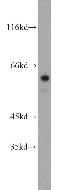 human brain tissue were subjected to SDS PAGE followed by western blot with Catalog No:114697(RIC8A antibody) at dilution of 1:200