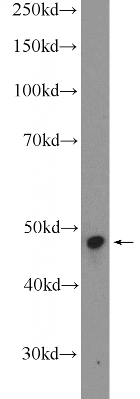 mouse heart tissue were subjected to SDS PAGE followed by western blot with Catalog No:107809(ABHD1 Antibody) at dilution of 1:600