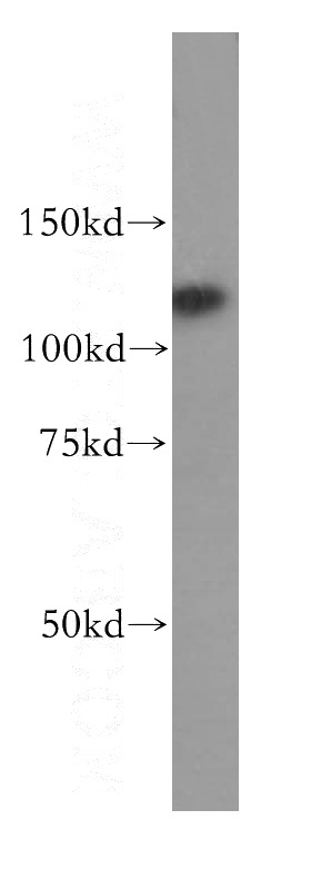 human brain tissue were subjected to SDS PAGE followed by western blot with Catalog No:114760(RNF40 antibody) at dilution of 1:300