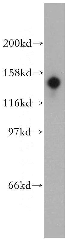 mouse testis tissue were subjected to SDS PAGE followed by western blot with Catalog No:115721(STK36 antibody) at dilution of 1:300