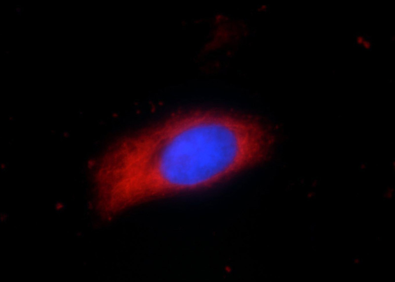 Immunofluorescent analysis of HeLa cells using Catalog No:114356(PYCR2 Antibody) at dilution of 1:50 and Rhodamine-Goat anti-Rabbit IgG