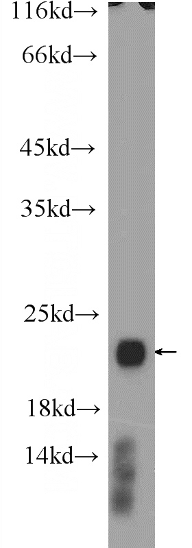 HL-60 cells were subjected to SDS PAGE followed by western blot with Catalog No:114506(RAC2 Antibody) at dilution of 1:600