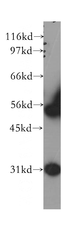 human kidney tissue were subjected to SDS PAGE followed by western blot with Catalog No:116973(WT1 antibody) at dilution of 1:300