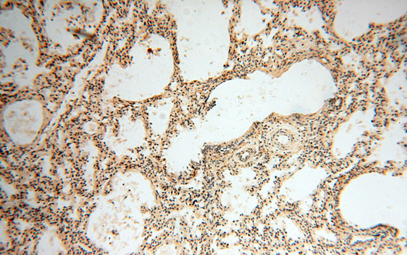Immunohistochemical of paraffin-embedded human lung using Catalog No:110872(GAS6 antibody) at dilution of 1:50 (under 10x lens)