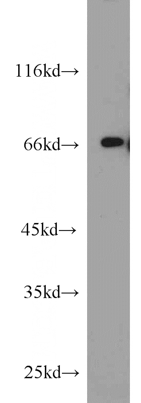 MCF7 cells were subjected to SDS PAGE followed by western blot with Catalog No:115924(TDP1 antibody) at dilution of 1:1000