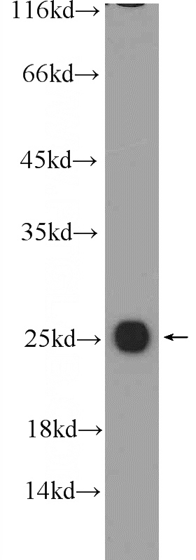 PC-3 cells were subjected to SDS PAGE followed by western blot with Catalog No:108672(C1orf163 Antibody) at dilution of 1:1000