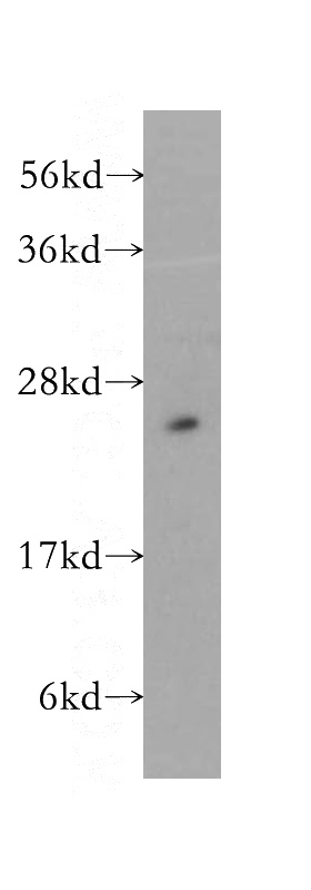 mouse testis tissue were subjected to SDS PAGE followed by western blot with Catalog No:114843(RPS3 antibody) at dilution of 1:500