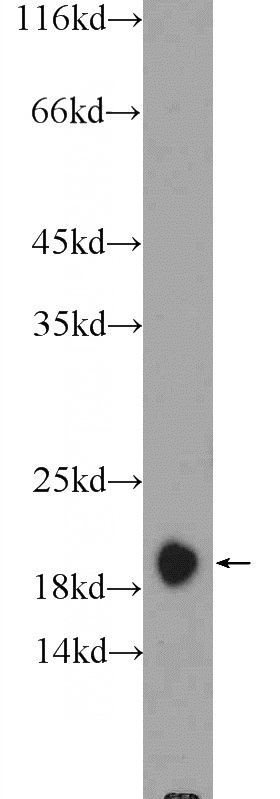 rat brain tissue were subjected to SDS PAGE followed by western blot with Catalog No:109260(Centrin 2 Antibody) at dilution of 1:600