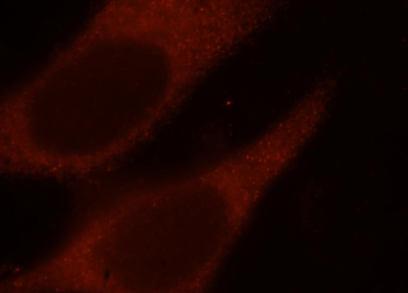 Immunofluorescent analysis of Hela cells, using IFT52 antibody Catalog No:111669 at 1:25 dilution and Rhodamine-labeled goat anti-rabbit IgG (red).