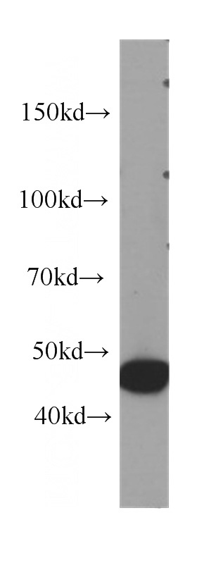 HeLa cells were subjected to SDS PAGE followed by western blot with Catalog No:107389(IL1R2 antibody) at dilution of 1:1000