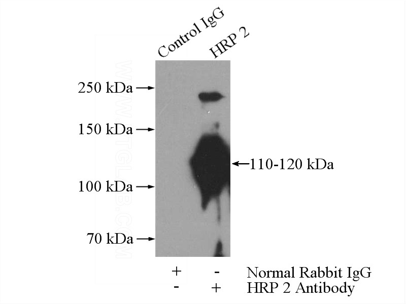 IP Result of anti-HDGF2 (IP:Catalog No:111465, 4ug; Detection:Catalog No:111465 1:500) with HepG2 cells lysate 3200ug.