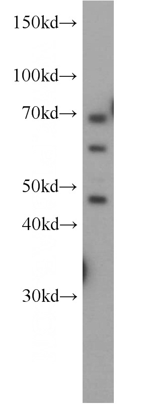 HeLa cells were subjected to SDS PAGE followed by western blot with Catalog No:113015(NAGA antibody) at dilution of 1:1000