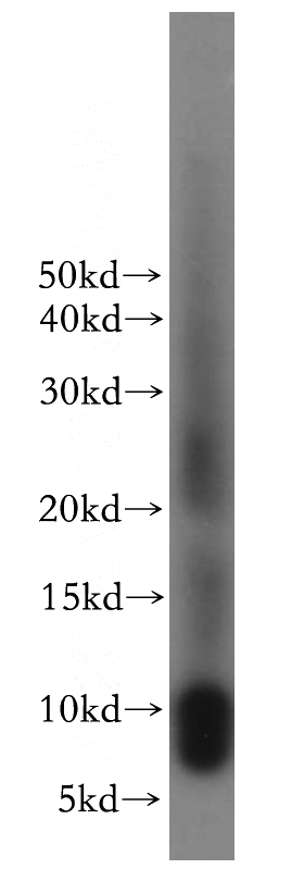 human heart tissue were subjected to SDS PAGE followed by western blot with Catalog No:116495(TUSC2 antibody) at dilution of 1:300