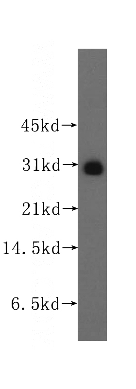 human lung tissue were subjected to SDS PAGE followed by western blot with Catalog No:114138(PPM1M antibody) at dilution of 1:500