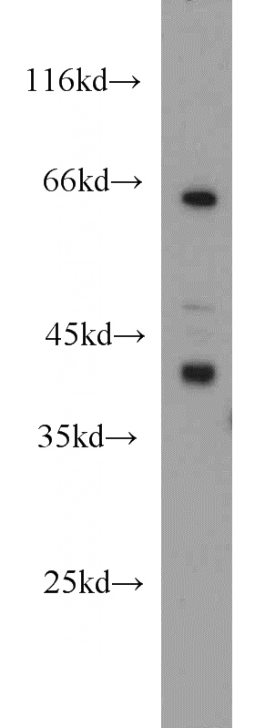 mouse brain tissue were subjected to SDS PAGE followed by western blot with Catalog No:111081(GLUL antibody) at dilution of 1:100