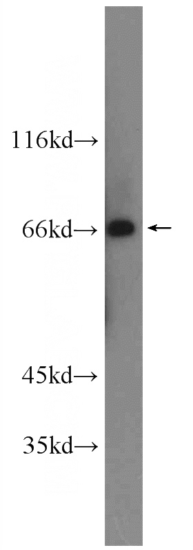 mouse liver tissue were subjected to SDS PAGE followed by western blot with Catalog No:114212(PRODH antibody) at dilution of 1:1000
