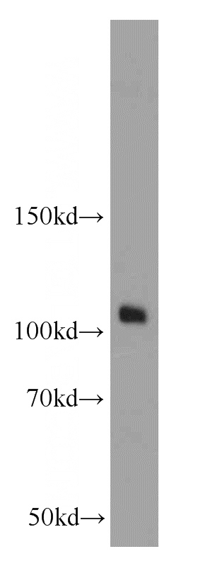 HeLa cells were subjected to SDS PAGE followed by western blot with Catalog No:108341(ATP1A1 antibody) at dilution of 1:2000