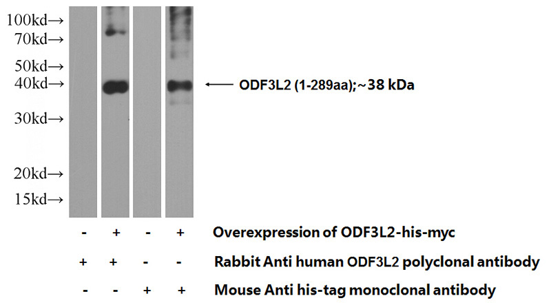 Transfected HEK-293 cells were subjected to SDS PAGE followed by western blot with Catalog No:113328(ODF3L2 Antibody) at dilution of 1:1000