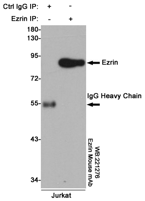 Immunoprecipitation analysis of Jurkat cell lysates using Ezrin mouse mAb.