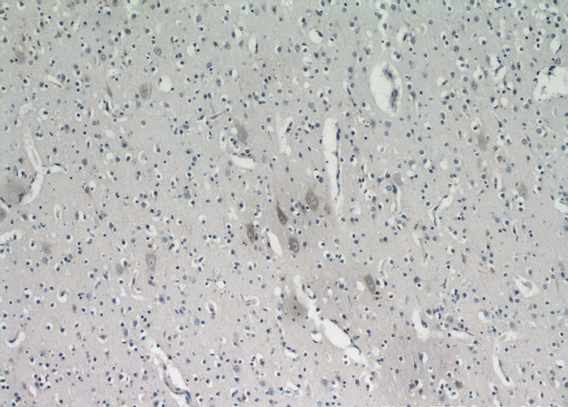 Immunohistochemical of paraffin-embedded human brain using Catalog No:112046(KIAA0319L antibody) at dilution of 1:100 (under 10x lens)