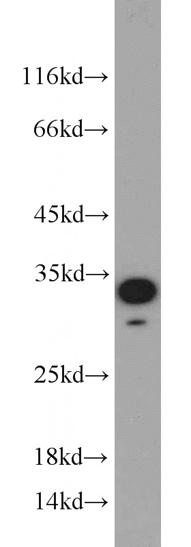 mouse skeletal muscle tissue were subjected to SDS PAGE followed by western blot with Catalog No:113293(NOL3 antibody) at dilution of 1:800