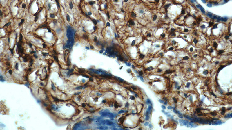 Immunohistochemistry of paraffin-embedded human placenta tissue slide using Catalog No:111449(PGDS Antibody) at dilution of 1:50 (under 40x lens)