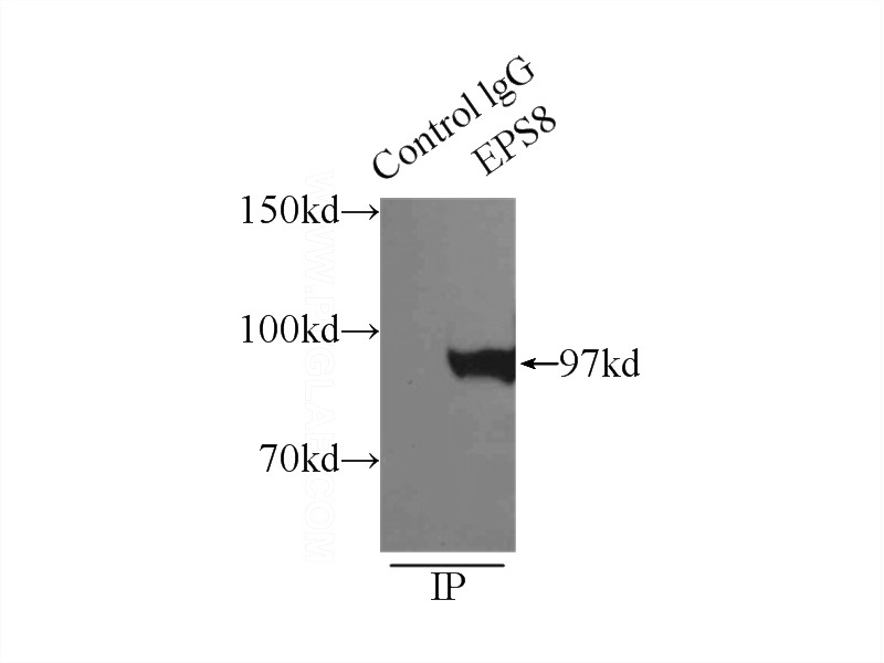 IP Result of anti-EPS8 (IP:Catalog No:110394, 3ug; Detection:Catalog No:110394 1:500) with HeLa cells lysate 3800ug.