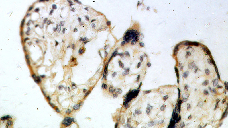 Immunohistochemical of paraffin-embedded human placenta using Catalog No:115307(SLC18A1 antibody) at dilution of 1:100 (under 40x lens)
