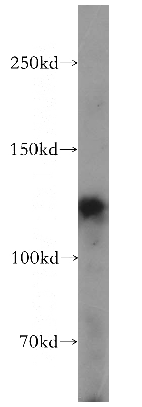 mouse liver tissue were subjected to SDS PAGE followed by western blot with Catalog No:110535(FBF1 antibody) at dilution of 1:500