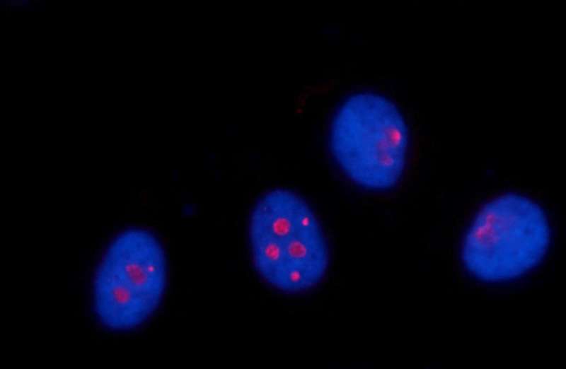 Immunofluorescent analysis of HepG2 cells using Catalog No:114847(RSL24D1 Antibody) at dilution of 1:25 and Rhodamine-Goat anti-Rabbit IgG