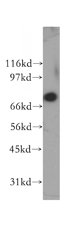 MCF7 cells were subjected to SDS PAGE followed by western blot with Catalog No:108152(ARMC8 antibody) at dilution of 1:400