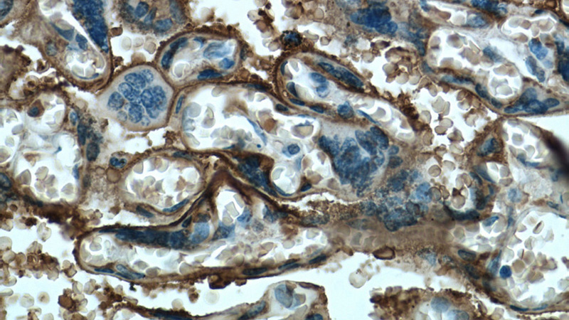Immunohistochemistry of paraffin-embedded human placenta tissue slide using Catalog No:107476(ALPP Antibody) at dilution of 1:100 (under 40x lens)