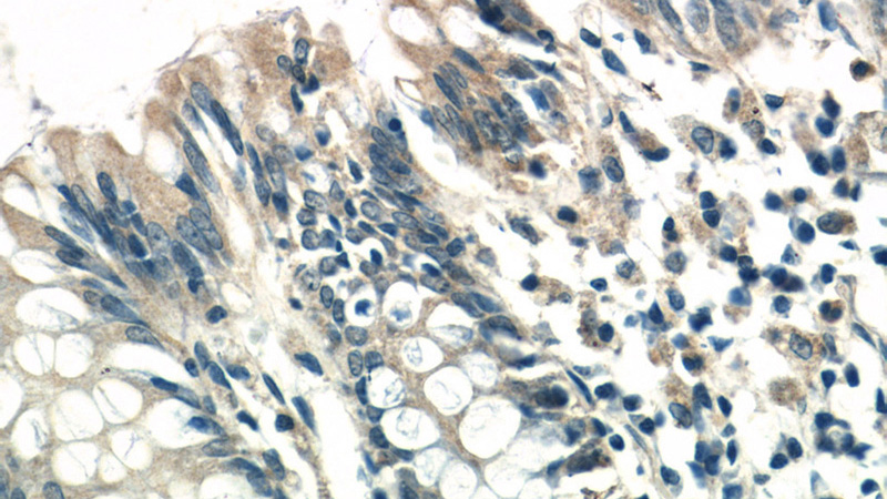 Immunohistochemistry of paraffin-embedded human colon tissue slide using Catalog No:116387(TTC7A Antibody) at dilution of 1:50 (under 40x lens)