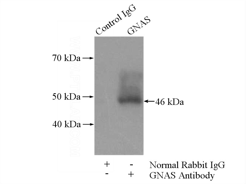 IP Result of anti-NESP55,GNAS (IP:Catalog No:110992, 4ug; Detection:Catalog No:110992 1:300) with mouse liver tissue lysate 4000ug.