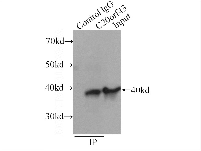 IP Result of anti-C20orf43 (IP:Catalog No:108703, 3ug; Detection:Catalog No:108703 1:500) with HeLa cells lysate 3440ug.