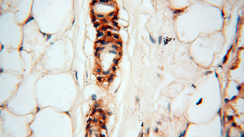 Immunohistochemical of paraffin-embedded human skin using Catalog No:116622(uPA antibody) at dilution of 1:50 (under 40x lens)