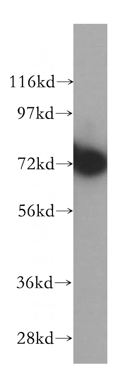 HeLa cells were subjected to SDS PAGE followed by western blot with Catalog No:114771(RNPEP antibody) at dilution of 1:500